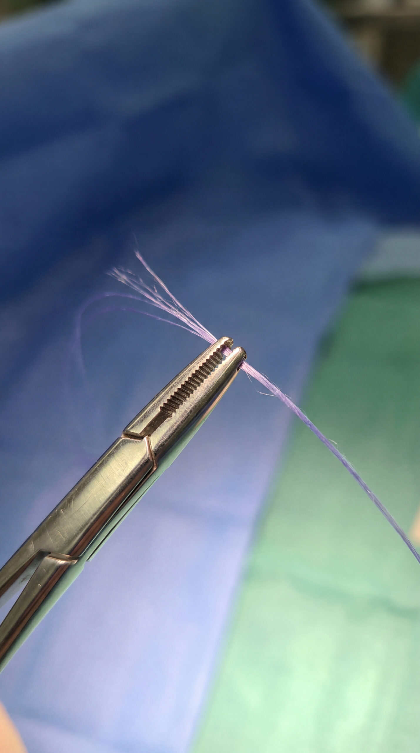 Perine Onarımı: İzlerin Silinmesi ve Kasların Sıkılaştırılması